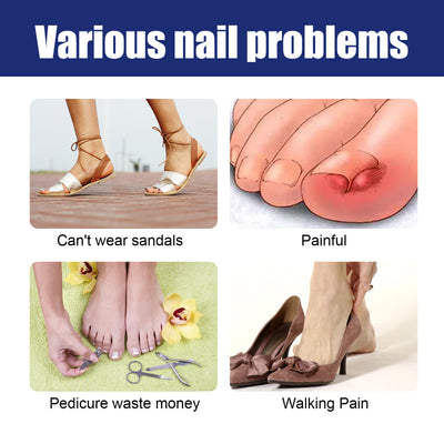 Nail Repair Solution
