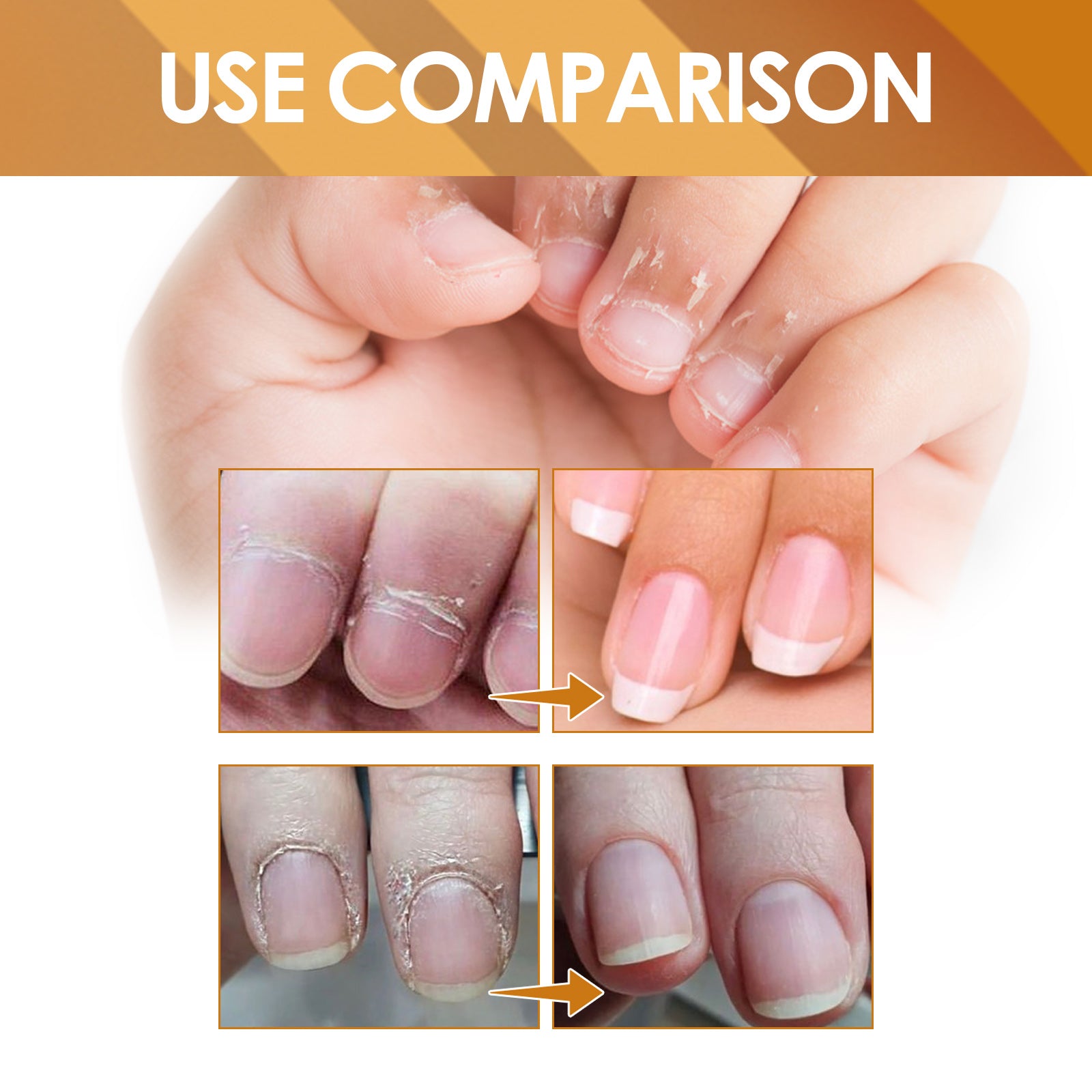 Moisturizing cuticle repair gel