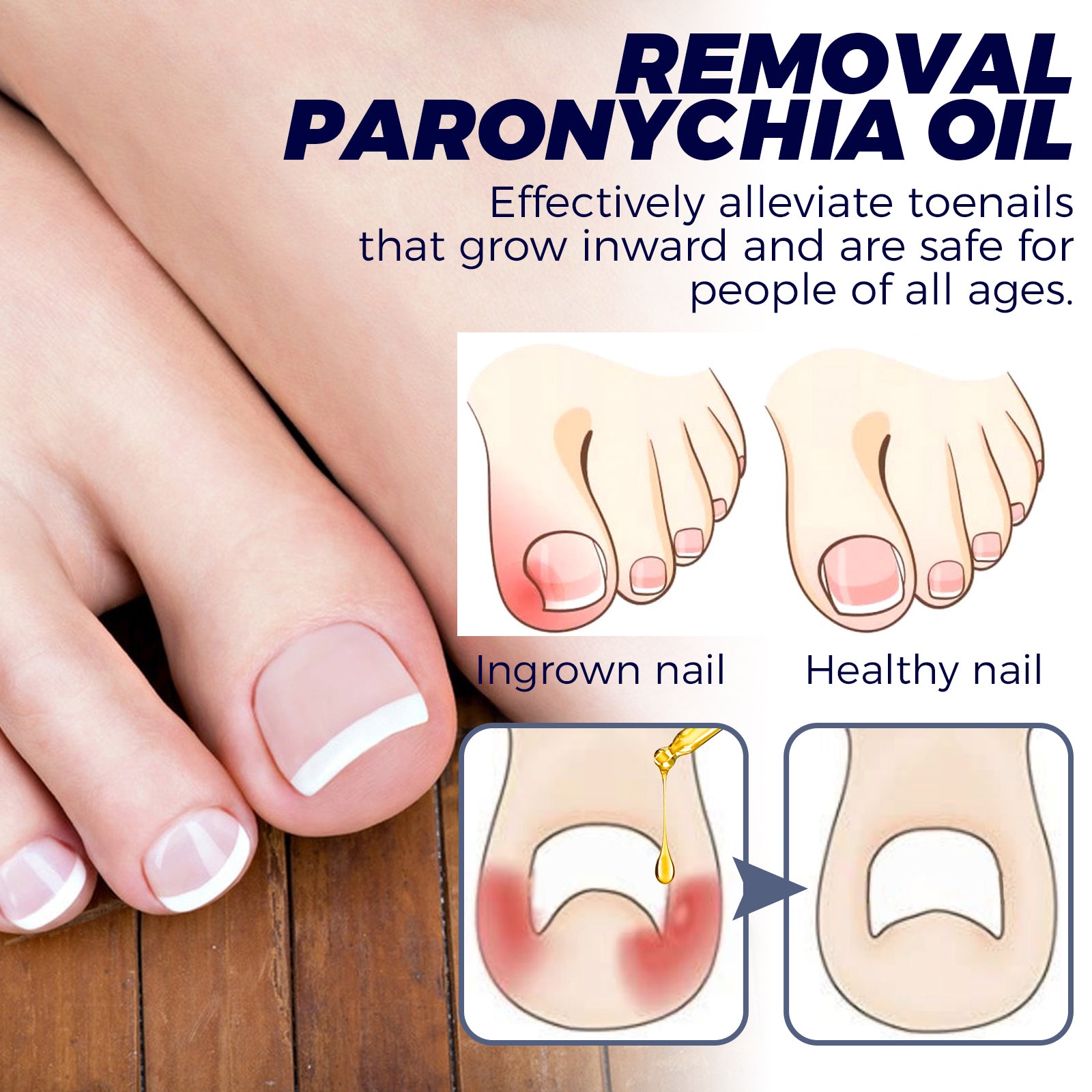 Nail Repair Oil  Moisturizing Nail Care