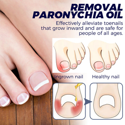 Nail Repair Oil  Moisturizing Nail Care