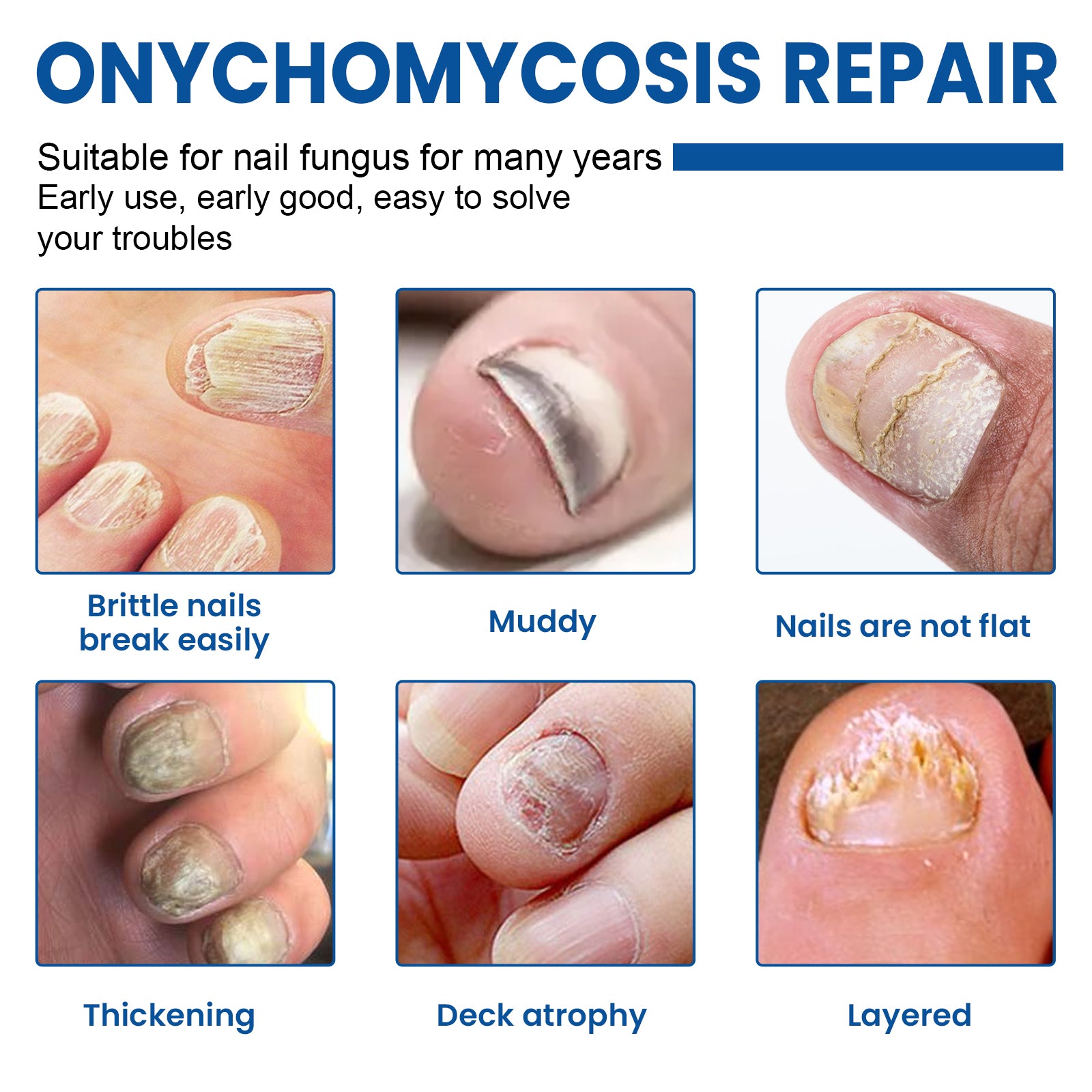 Hand and foot nail repair patches